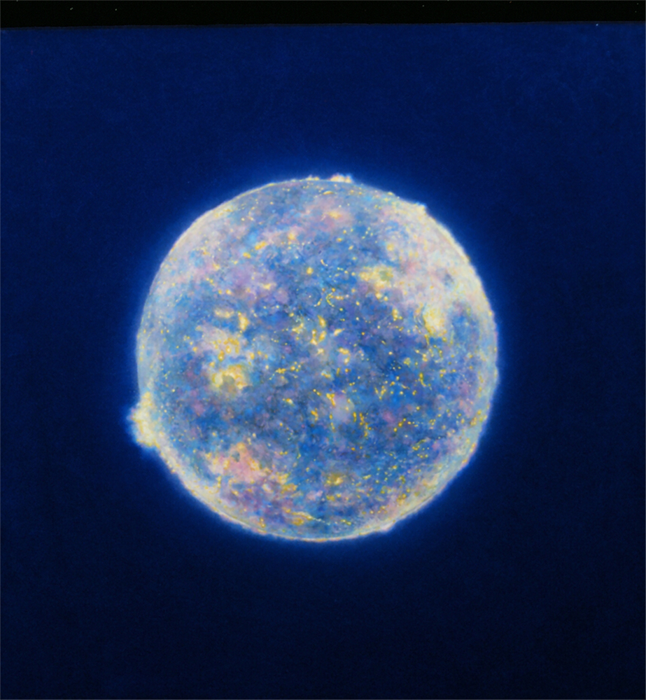 24340001-m